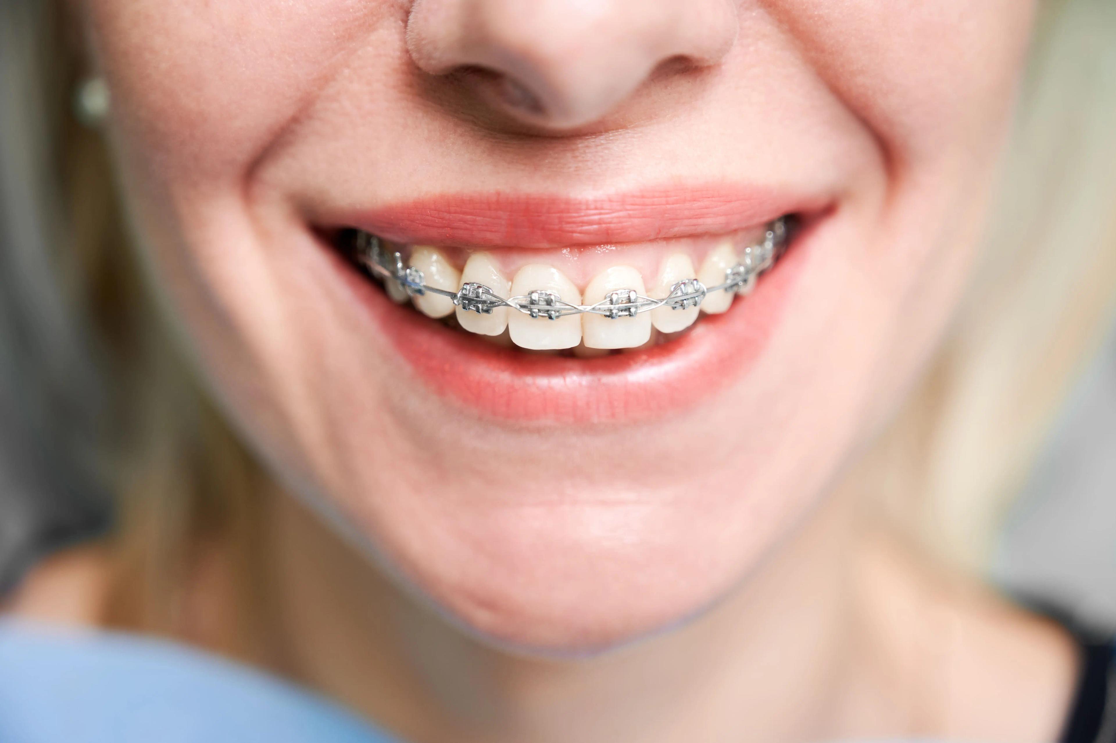 What is orthodontics? preview