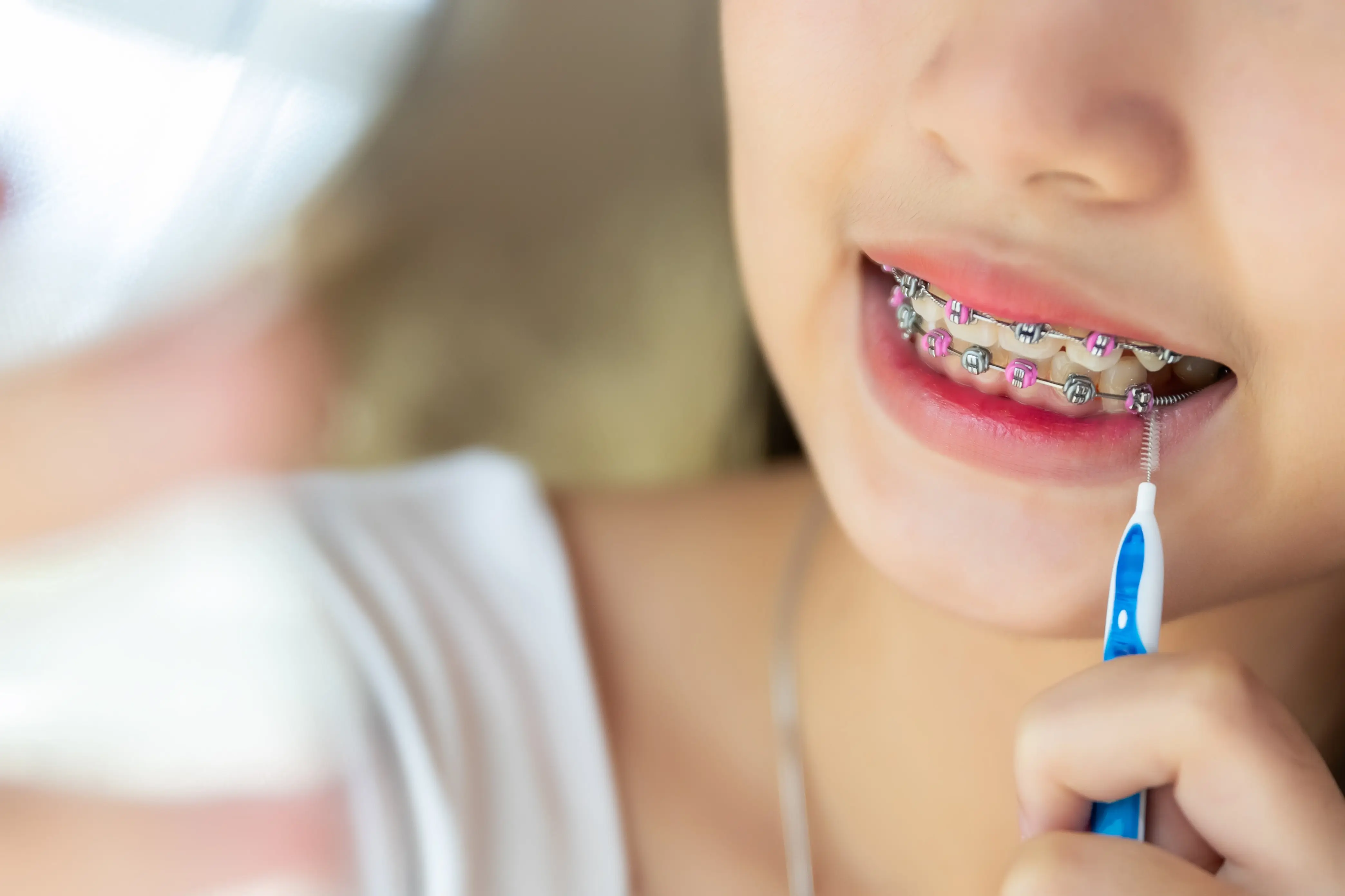 Fixed braces at Taverham preview