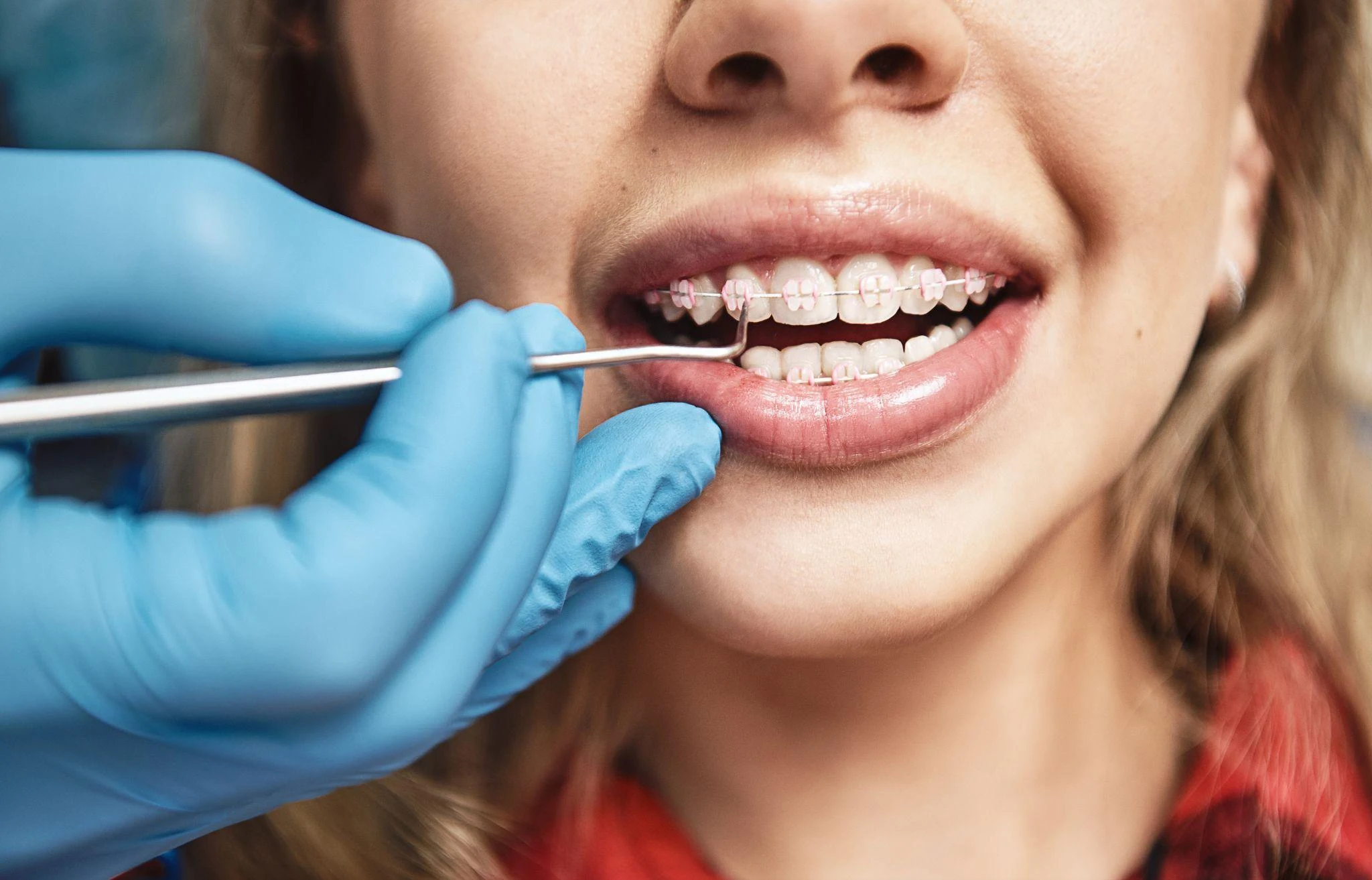 A dental professional checking a patient's fixed braces