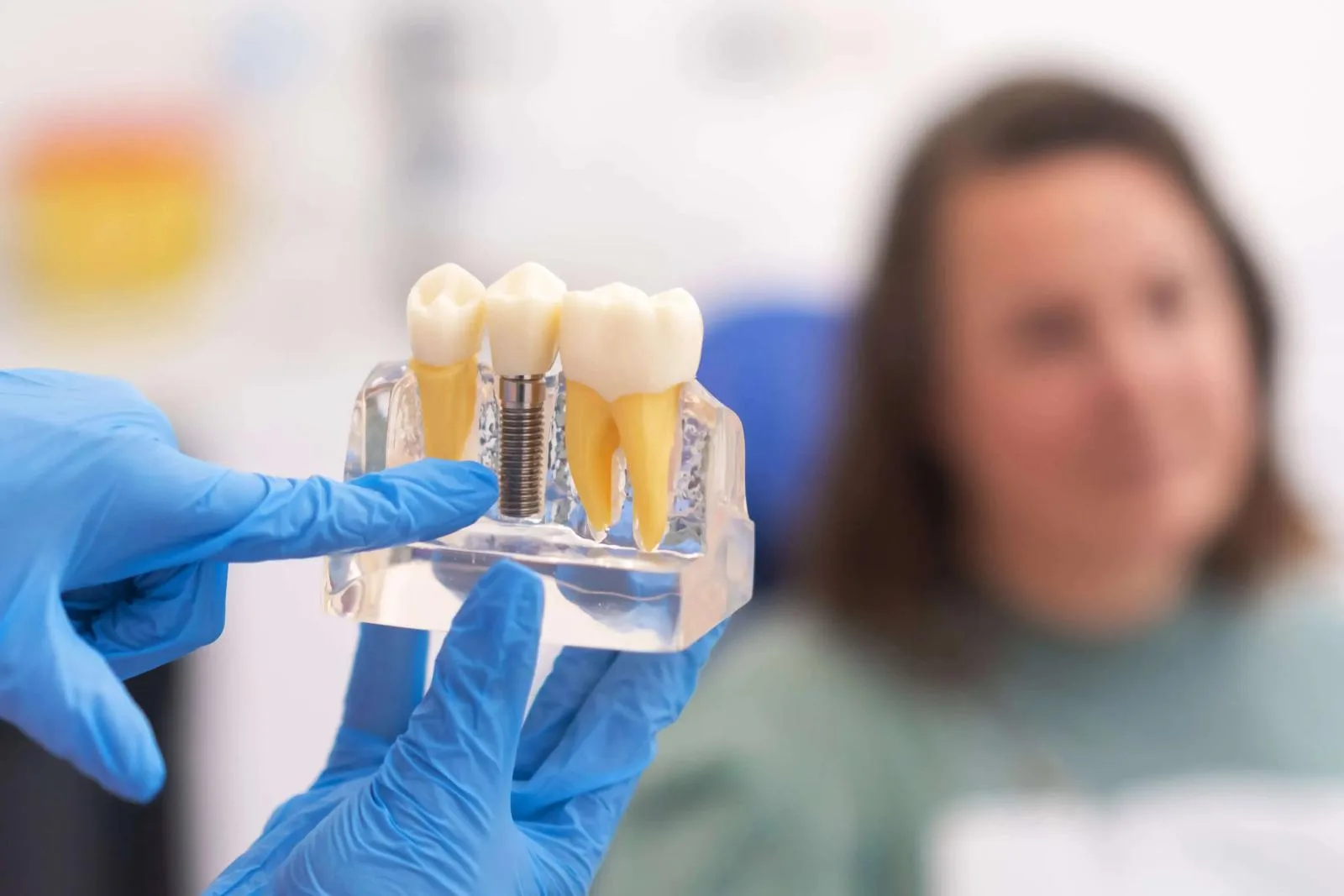 Restore Your Smile with Premium Dental Implants and Restorations after photo