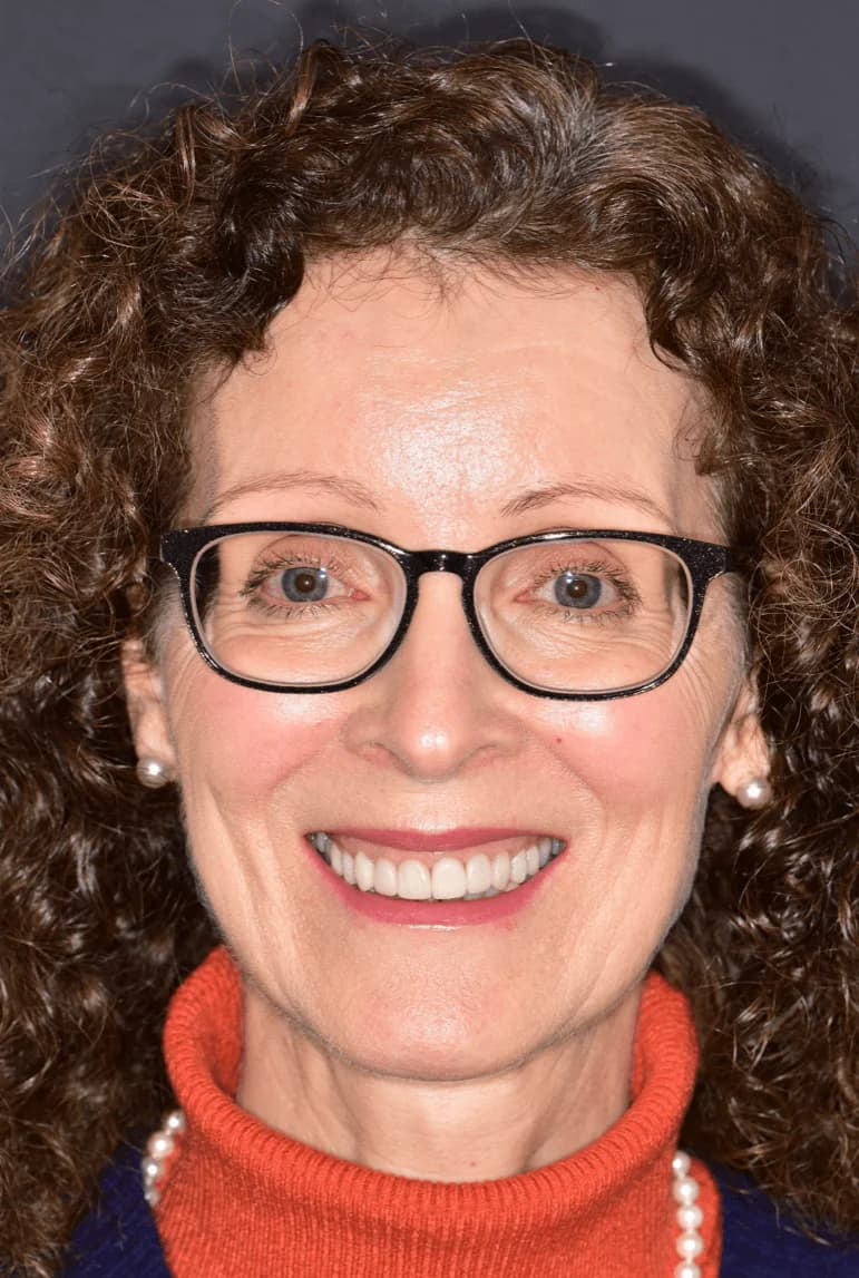 Smile Makeover at Taverham Dental, Norwich after photo