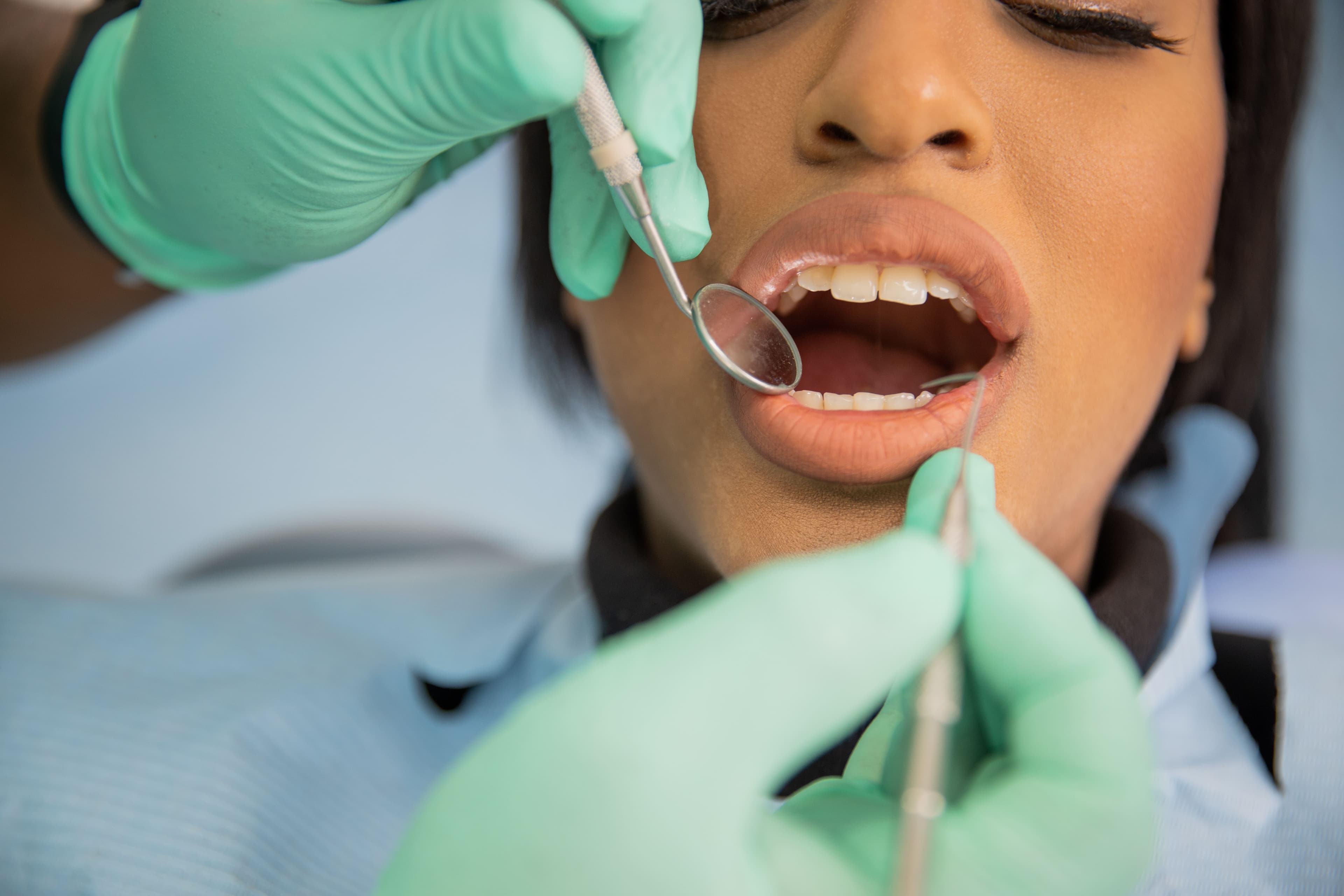 Why Regular Dental Check-Ups Are Essential – Taverham Dental, Dentists Norwich after photo